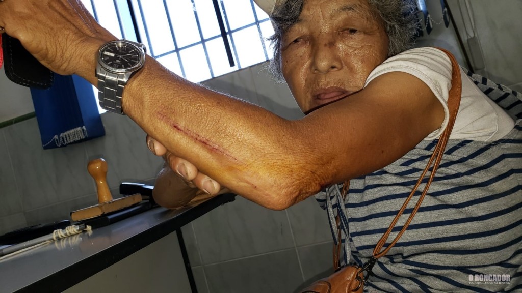 Japonesinha Rosa sofre agressão em sua própria residência em Nova Xavantina