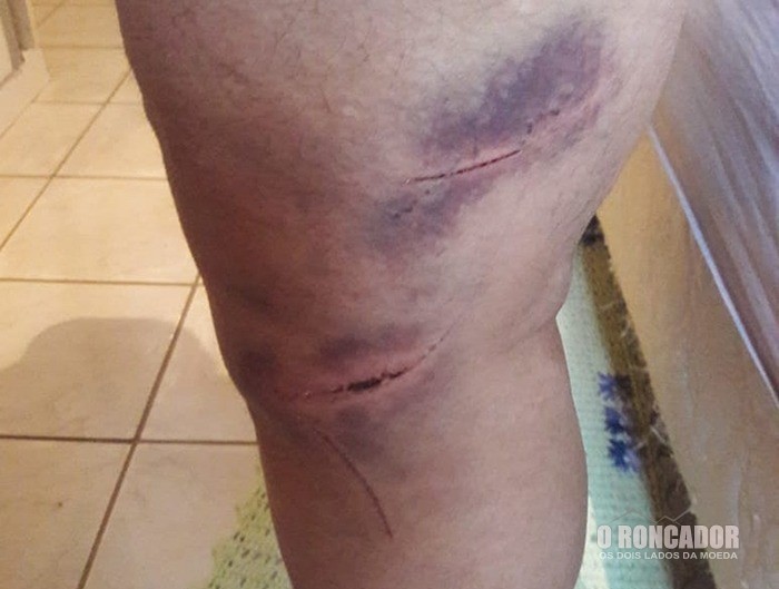 ‘Tentei correr e não consegui’, diz pastor que foi atacado pelas costas durante culto em igreja de MT