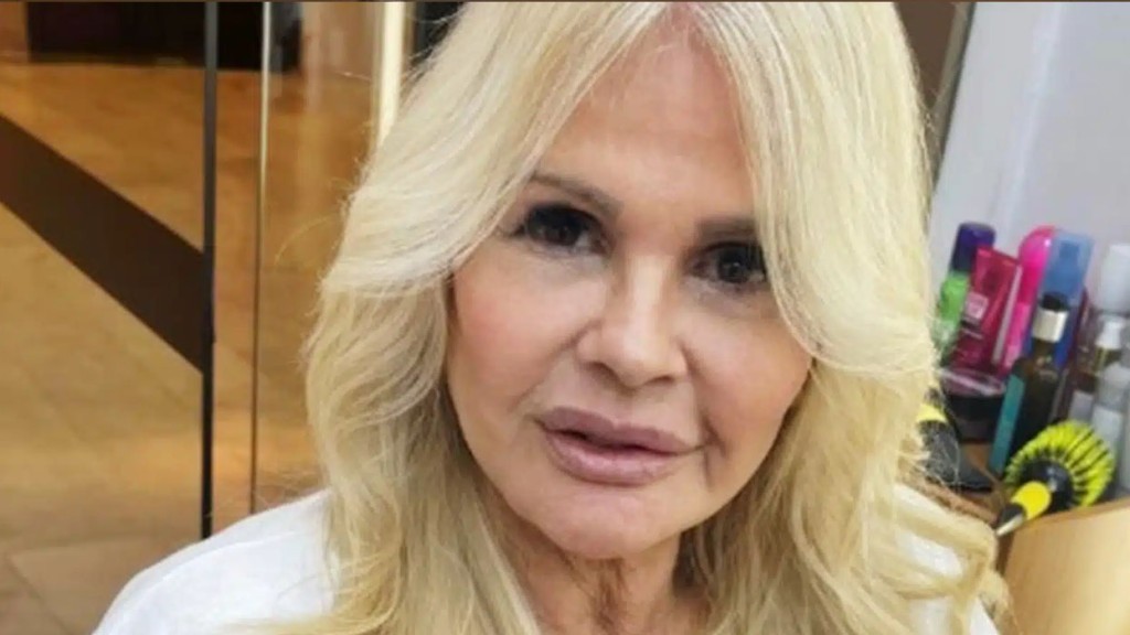 Monique Evans mostra recuperação após minilifting facial e revela confiança